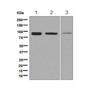 ANTI-LAS1L ANTIBODY [EPR8988(B)]  - VIAL X 100 UL - ABCAM