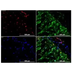 ALEXA FLUOR 647 ANTI-CD31 ANTIBODY [JC/70A] - VIAL X 100 UL -ABCAM