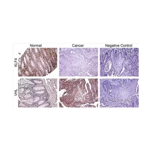 RABBIT SPECIFIC HRP/DAB DETECTION IHC KIT - FRASCO X 15 ML - ABCAM