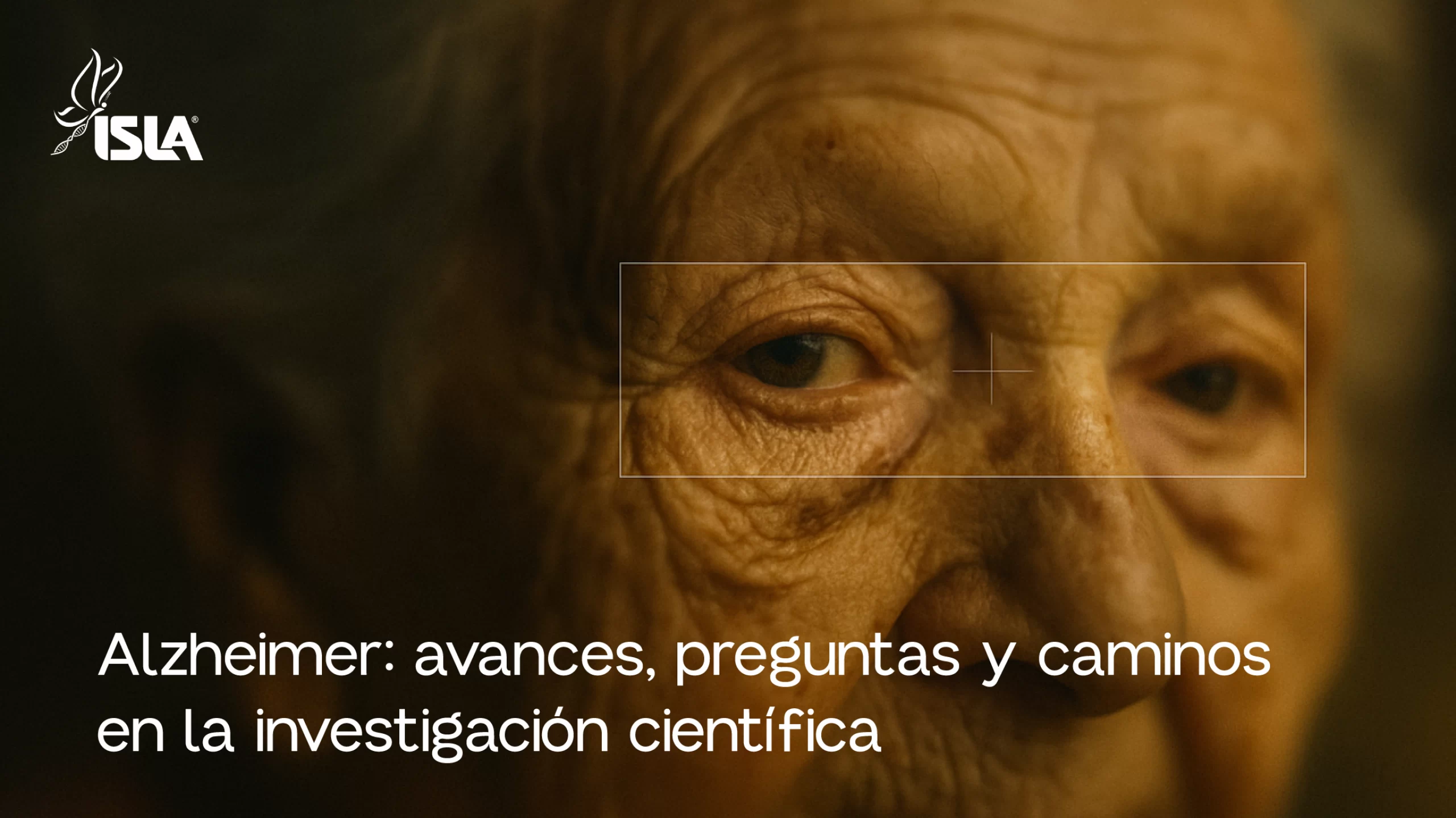 Alzheimer: Avances preguntas y caminos en la investigación cientifica en Colombia